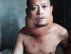 Derita Tumor Region Colli Multipel, Warga Cikolek Ini Perlu Uluran Tangan dan Bantuan