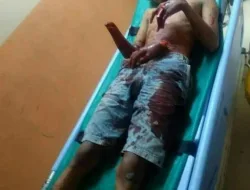 Bentrokan Pemuda Sadis di Pekanbaru, Berikut Kronologinya