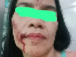 Korban Jadi Tersangka: Kasus Penganiayaan di Buton Tengah Tuai Sorotan