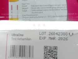 Diagnosa Awal Puskesmas Talawi Keliru, Siswi SMP Alami Trauma Berat